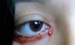 Gặp cô gái khóc ra... máu