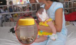 50 con dòi 'ăn' đứt tai bé gái 5 tháng tuổi