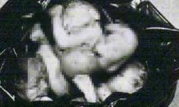 Bát hương di động của nữ y tá chuyên nạo thai