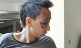 Sát hại dã man bạn dì ruột bằng 14 nhát dao