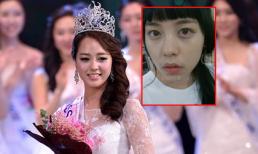 Tân hoa hậu Hàn lại bị mổ xẻ nhan sắc