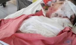 Tạt nguyên xô 5 lít a xít vào chồng tại bến xe buýt