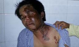 Người đàn bà thú tính nổi cơn ghen điên loạn