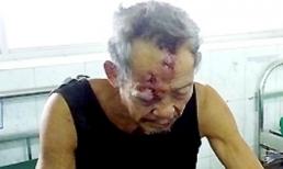 64 tuổi đâm chết 2 thanh niên khỏe mạnh vì... tè bậy