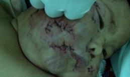 Rùng mình cảnh mẹ dùng vật nhọn đâm khắp người con trai 8 tháng tuổi