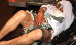 Bị cắt "của quý" vì dám cưới con gái nhà người khác