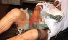 Tự tay cắt phăng của quý sau khi uống 'bia cỏ'