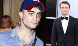 Sốc với hình ảnh "xuống sắc" thảm hại của sao "Harry Potter"