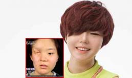 Giật mình gương mặt của cô gái sau phẫu thuật thẩm mỹ