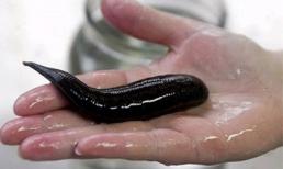 Kinh hãi đỉa sống trong mũi người suốt 3 tháng