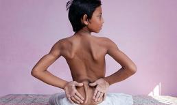 Cậu bé 12 tuổi có đuôi, được coi như thánh sống