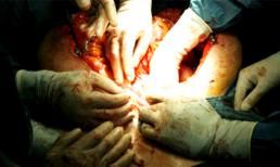 Điều tra đường dây buôn bán nội tạng, 150 triệu đồng/quả thận