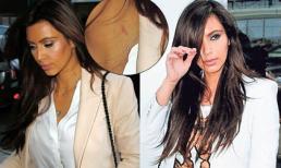 Sao lộ "vết yêu cuồng" trên cổ