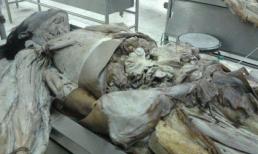 Rùng rợn cảnh 'xẻ thịt' ở nhà xác Đại học Y TP.HCM