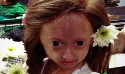 Bé gái 6 tuổi thân thể bà già