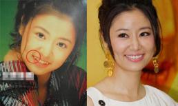 Ngạc nhiên với ảnh cũ thời chưa niềng răng của Lâm Tâm Như