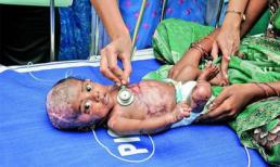 Em bé có làn da tự phát ra khí gas gây cháy