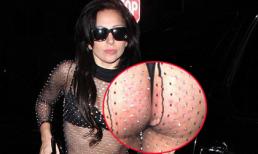 Lady Gaga diện jumpsuit thủng "khoe" mông lấm tấm mụn