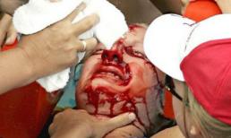 Những cái chết "từ trên trời rơi xuống" oái oăm nhất thế giới (P1)