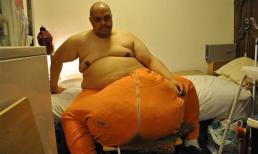 Phẫu thuật cho người đàn ông có "của quý" nặng nhất thế giới