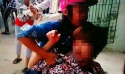 Bị đánh hội đồng, nữ sinh đâm rách mắt bạn