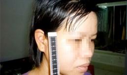 Bác sĩ lột quần áo, đánh đập vợ sẩy thai