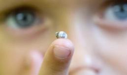 Ốc sên làm tổ trong... đầu gối cậu bé 4 tuổi