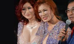 Hai chị em "ngực khủng" lộ mặt nhăn nhúm vì thẩm mỹ quá đà