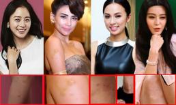 Những "vết tích" khó hiểu trên cơ thể sao (P3) 