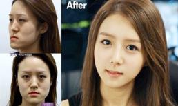 Cô gái xấu xí được phẫu thuật thành 'bản sao YoonA (SNSD)'
