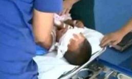 Kinh hoàng: Bé trai 6 tuổi bị đánh thuốc mê móc mất hai mắt