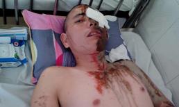 Vụ tạt axít 5 người: Vì bị ngăn cản tình yêu với cô bé 10 tuổi