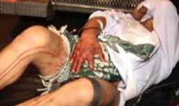 Vợ cắt phăng 'của quý' của chồng rồi bỏ trốn