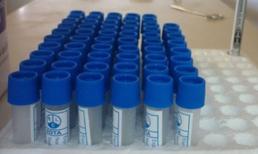 Sự thật khó tin vụ "nhân bản" kết quả xét nghiệm