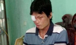 Gặp nạn nhân vụ tạt axit kinh hoàng vì ghen