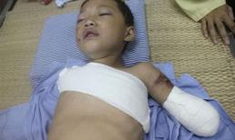 Bé trai 5 tuổi bị gấu cắn đứt lìa tay ở Phú Thọ