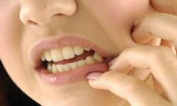 Mẹo chữa đau răng cực hiệu quả