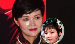Mỹ nhân "Hồng lâu mộng" tái xuất với gương mặt cứng đơ, bóng nhẫy