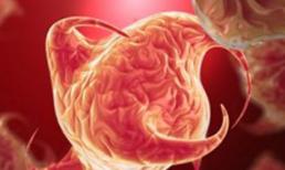 Những nguyên tắc "vàng" khi điều trị ung thư