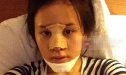  Khuôn mặt sưng tấy của Bà Tưng sau phẫu thuật thẩm mĩ