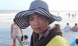 Rùng mình vì Lê Khánh bị tạt a xít nát nửa mặt