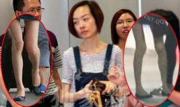 Sốc với chân tay cong queo của MC gầy nhất Trung Quốc