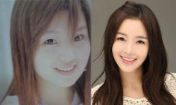 Nhan sắc tầm thường của mỹ nhân Hàn trước 'dao kéo'