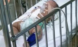 Lời kể rùng rợn của hàng xóm khi thấy ruột cháu bé rơi ra ngoài