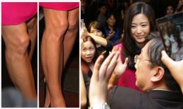 'Minh tinh trái đất' lộ đầu gối xấu xí khi xuất hiện ở Đài Loan