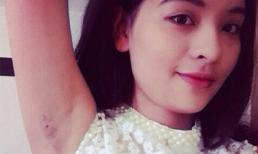 Trào lưu khoe vùng da dưới cánh tay của giới trẻ