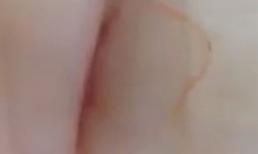 Giun sán bò lổm ngổm trên miếng thịt lợn mua trong siêu thị