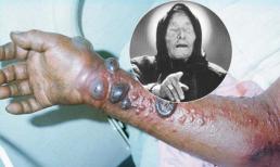 Hoang mang vì lời tiên tri 2014 của Vanga ứng nghiệm?