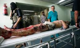 Rợn người hình ảnh chết chóc ở tâm đại dịch Ebola