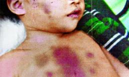 Không sinh được con trai, mẹ giết chết con gái 7 tháng tuổi